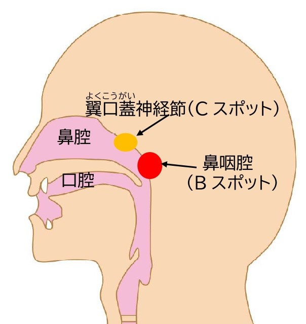 慢性上咽頭炎（EAT;Bスポット療法） ｜ 楓みみはなのどクリニック｜一宮市