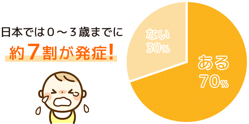 子どもがかかりやすい、急性中耳炎